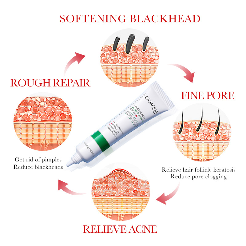 1/2/3 個 BIOAQUA サリチル酸フェイスクリームに - Salicylic Acid Blackhead Remover のレビューと価格