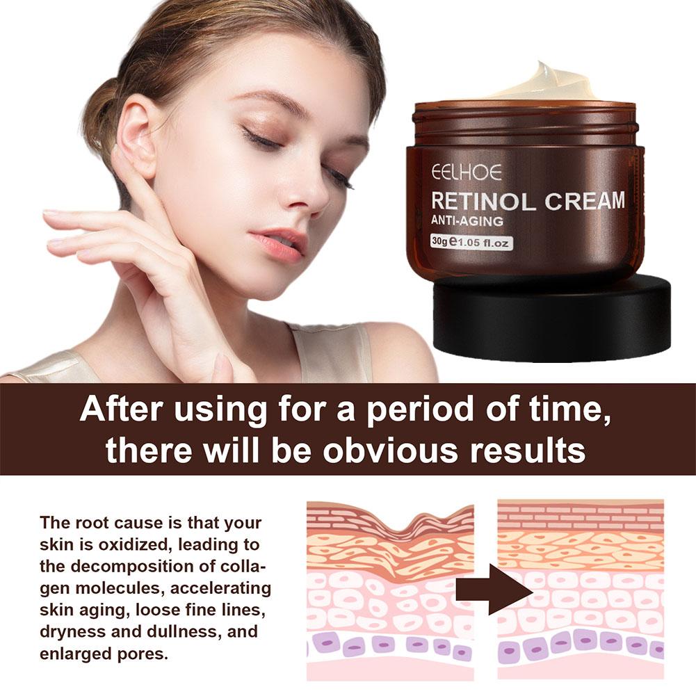 EELHOE 1/2/3/5 個 (3 個購入すると 2 個 - Retinol Anti Wrinkle Cream のレビューと価格