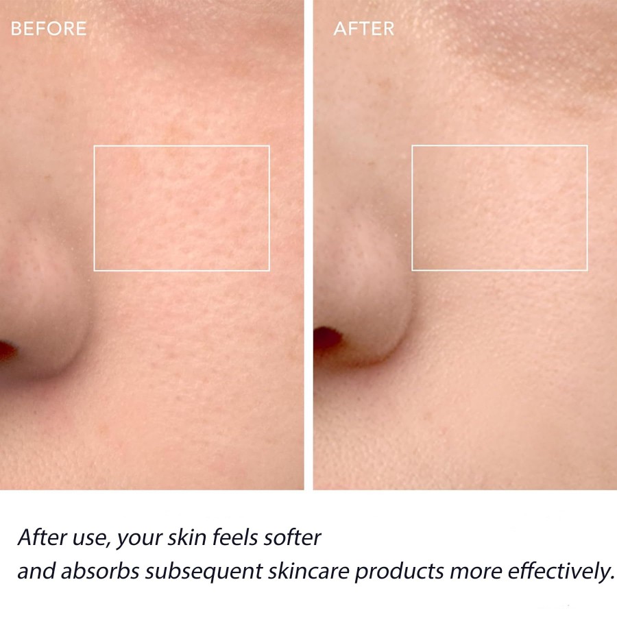 洗顔ブラシ、充電式フェイススクラバー、IPX7防水、自動泡立 - Silicone Face Scrubber Electric のレビューと価格