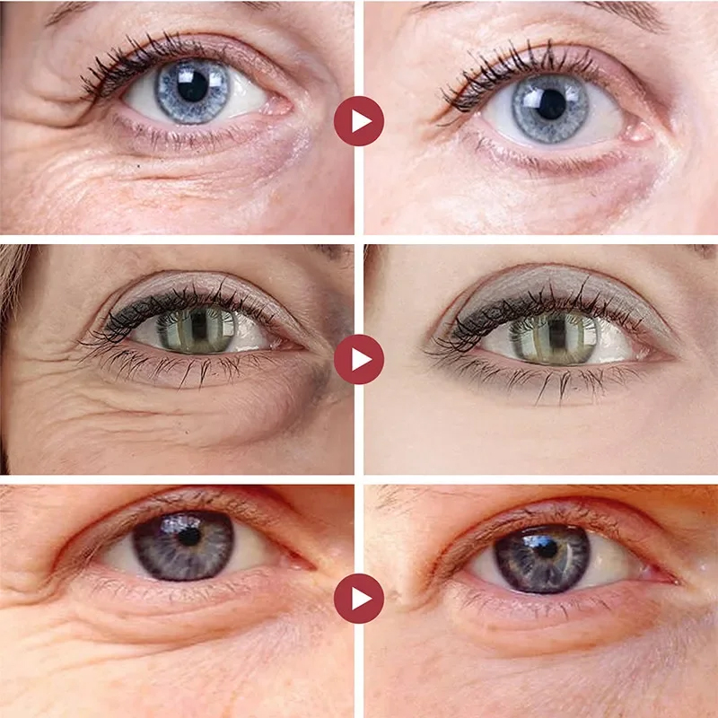 しわ除去アイパッチ引き締めリフティングコラーゲンアイマスク小 - Collagen Under Eye Patches のレビューと価格